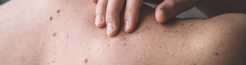 skincarelarocheposaycosanonfaredurantechemioterapianuovoarticolomaggio24