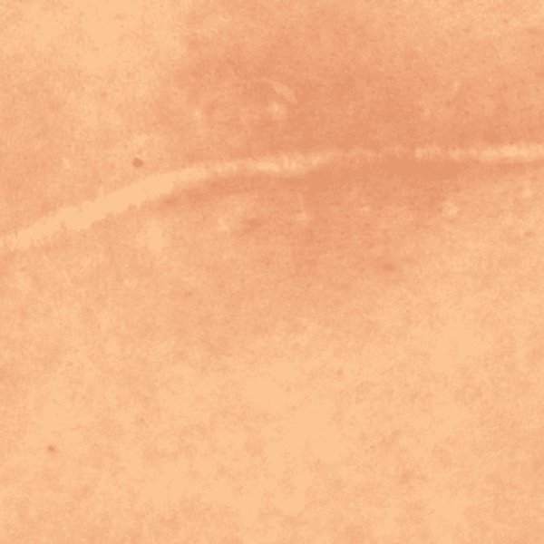 Trattamento delle Cicatrici Chiuse: Cosa Fare? | La Roche Posay