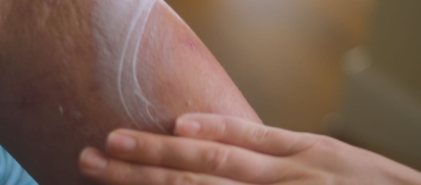 Chemioterapia: Quali Effetti Collaterali? | La Roche Posay