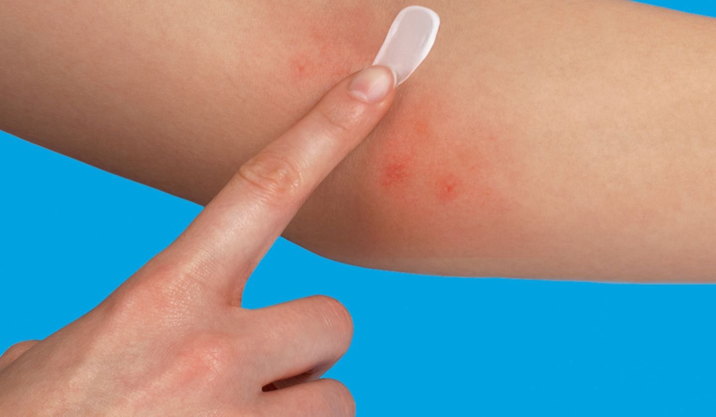 Irritazione da Ciuccio: Rimedi e Consigli | La Roche Posay