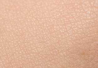 Larocheposay ArticlePage Sun Pregnancy pigmentation and sunscreen