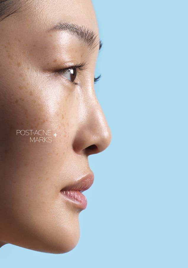 /-/media/project/loreal/brand-sites/lrp/emea/it/products/effaclar/effaclar-a-z-gel-cream/desktop/lrp-effaclar_azcream_flip_card_front_desktop_3.jpg